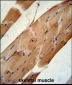 CNO6L Antibody (C-term)